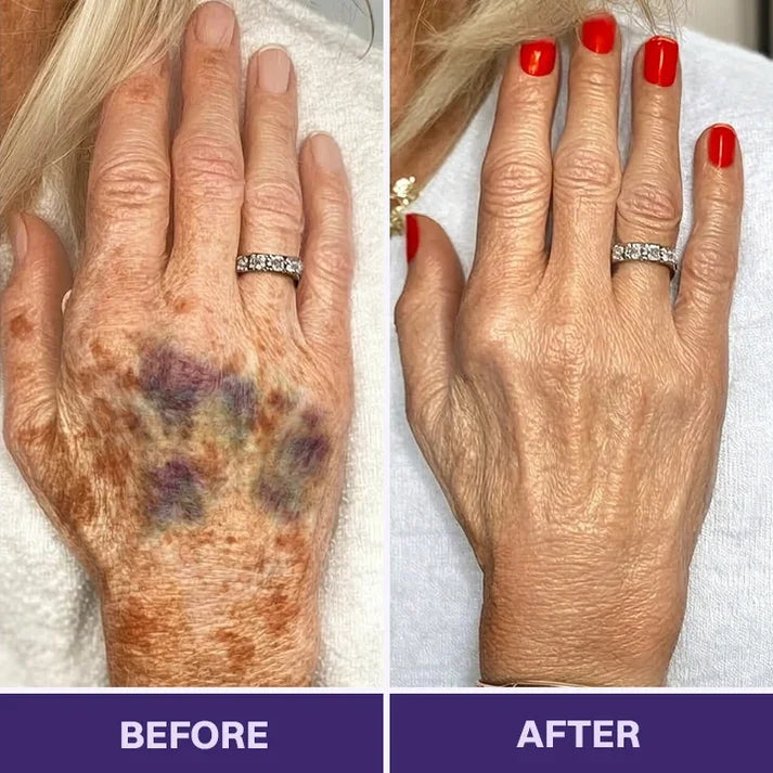 TOPSPIRE® Bruise Repair & Skin-Strengthening Cream