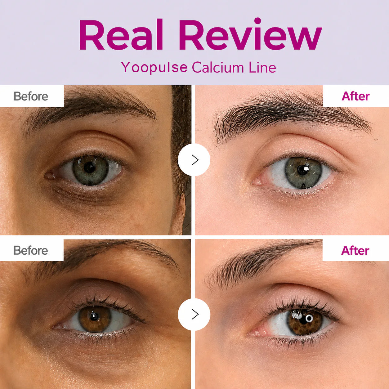 🔥LAST DAY 50% OFF!! Yoopulse Korean Calcium Dark Spot Eye Cream