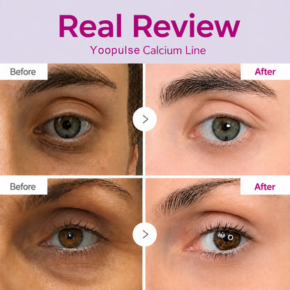🔥LAST DAY 50% OFF!! Yoopulse Korean Calcium Dark Spot Eye Cream