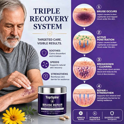TOPSPIRE® Bruise Repair & Skin-Strengthening Cream