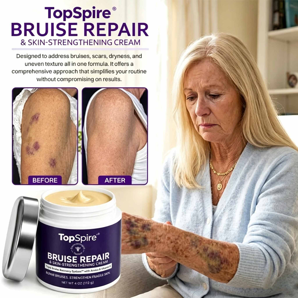 TOPSPIRE® Bruise Repair & Skin-Strengthening Cream