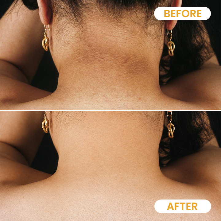 Yoopulse ® Turmeric Exfoliating Body Scrub
