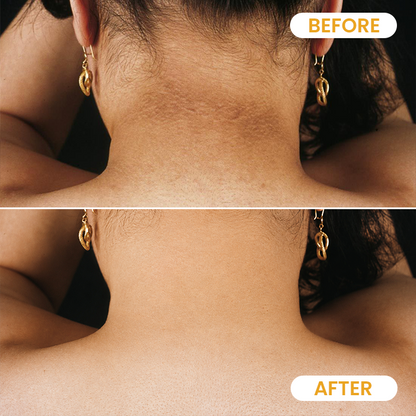 Yoopulse ® Turmeric Exfoliating Body Scrub
