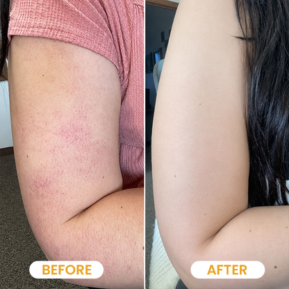 Yoopulse ® Turmeric Exfoliating Body Scrub