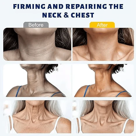 ✨ Yoopulse™ Instant Neck Lift Cream — 🧴 Infused with Retinol & Hyaluronic Acid | Firms the Neck, Reduces Wrinkles