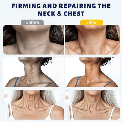 ✨ Yoopulse™ Instant Neck Lift Cream — 🧴 Infused with Retinol & Hyaluronic Acid | Firms the Neck, Reduces Wrinkles