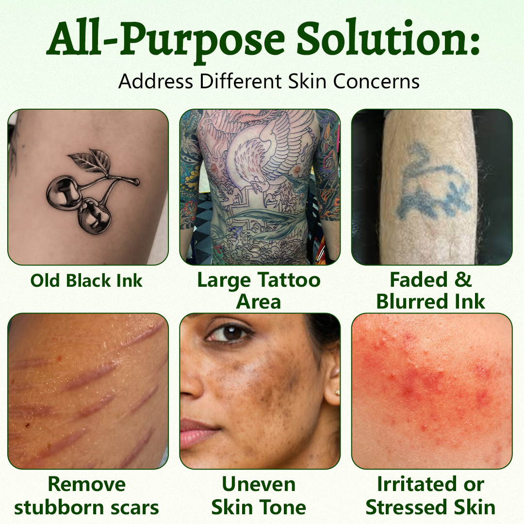 Yoopulse® PureAlgae Ink Removal Support Spray 🌿 — Say Goodbye to Old Tattoo Pigment 💚, Fade Stubborn Ink ✨, Repair & Smooth Treated Skin 💧, Non-Laser ✅, Try It Now! 🔥