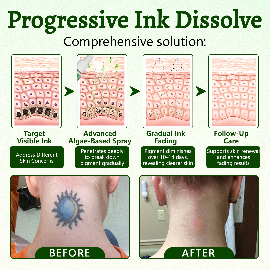 Yoopulse® PureAlgae Ink Removal Support Spray 🌿 — Say Goodbye to Old Tattoo Pigment 💚, Fade Stubborn Ink ✨, Repair & Smooth Treated Skin 💧, Non-Laser ✅, Try It Now! 🔥