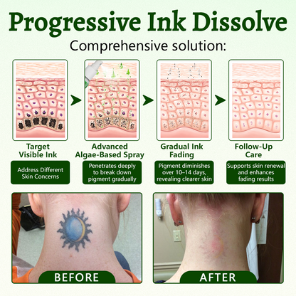 Yoopulse® PureAlgae Ink Removal Support Spray 🌿 — Say Goodbye to Old Tattoo Pigment 💚, Fade Stubborn Ink ✨, Repair & Smooth Treated Skin 💧, Non-Laser ✅, Try It Now! 🔥