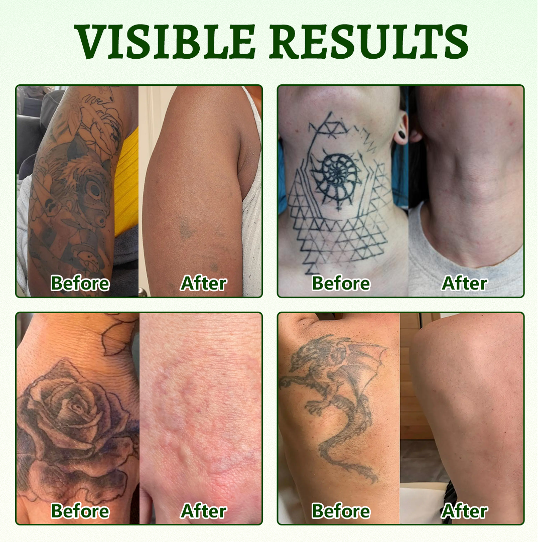 Yoopulse® PureAlgae Ink Removal Support Spray 🌿 — Say Goodbye to Old Tattoo Pigment 💚, Fade Stubborn Ink ✨, Repair & Smooth Treated Skin 💧, Non-Laser ✅, Try It Now! 🔥