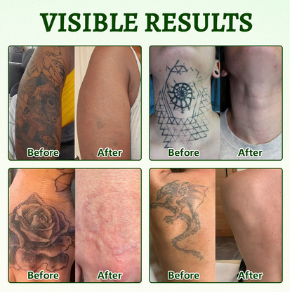 Yoopulse® PureAlgae Ink Removal Support Spray 🌿 — Say Goodbye to Old Tattoo Pigment 💚, Fade Stubborn Ink ✨, Repair & Smooth Treated Skin 💧, Non-Laser ✅, Try It Now! 🔥