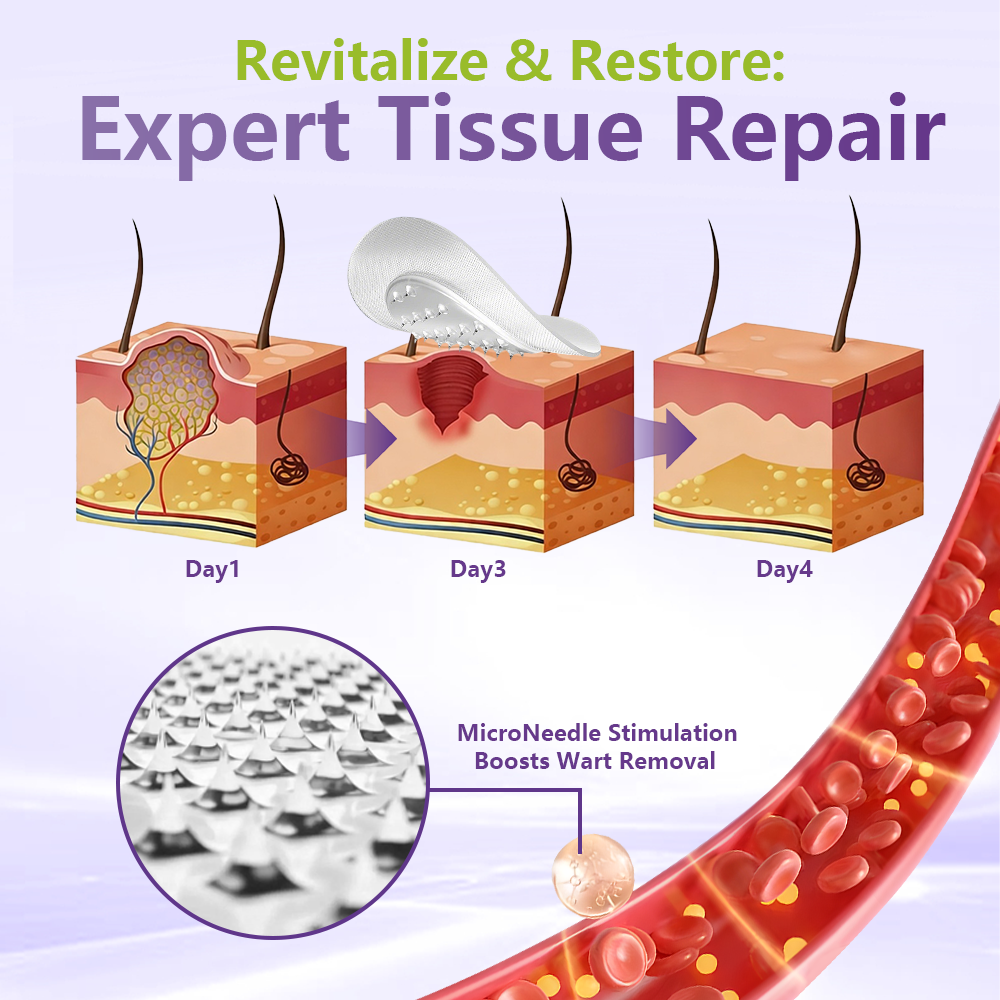 💗YOOPULSE® SOLUBLE MICRONEEDLE BOTANICAL SKIN TAG REMOVAL PATCH-ZDJ
