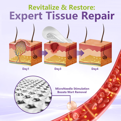 💗YOOPULSE® SOLUBLE MICRONEEDLE BOTANICAL SKIN TAG REMOVAL PATCH-ZDJ