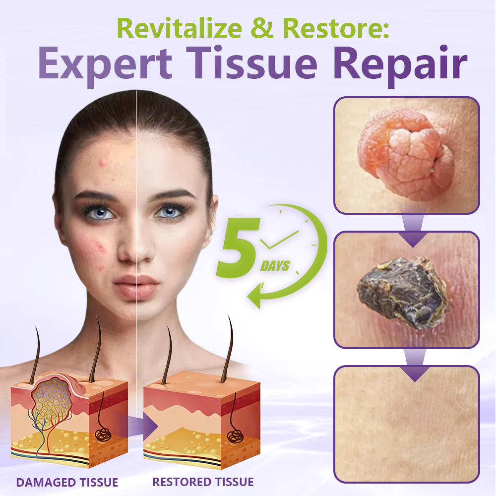 💗YOOPULSE® SOLUBLE MICRONEEDLE BOTANICAL SKIN TAG REMOVAL PATCH-ZDJ