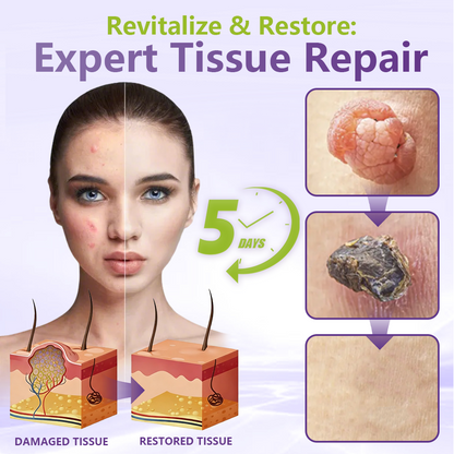 💗YOOPULSE® SOLUBLE MICRONEEDLE BOTANICAL SKIN TAG REMOVAL PATCH-ZDJ
