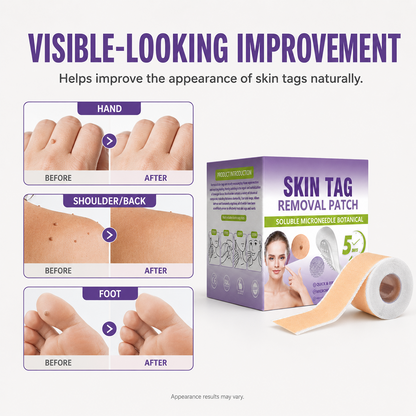 💗Yoopulse® Botanical Micro-Point Skin Care Patches for Small Bumps