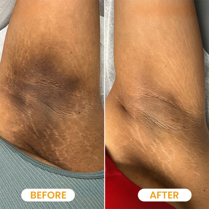 Yoopulse ® Turmeric Exfoliating Body Scrub