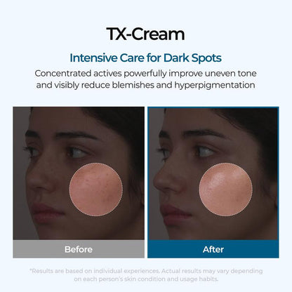 TX Cream – Dark Spot & Hyperpigmentation Corrector