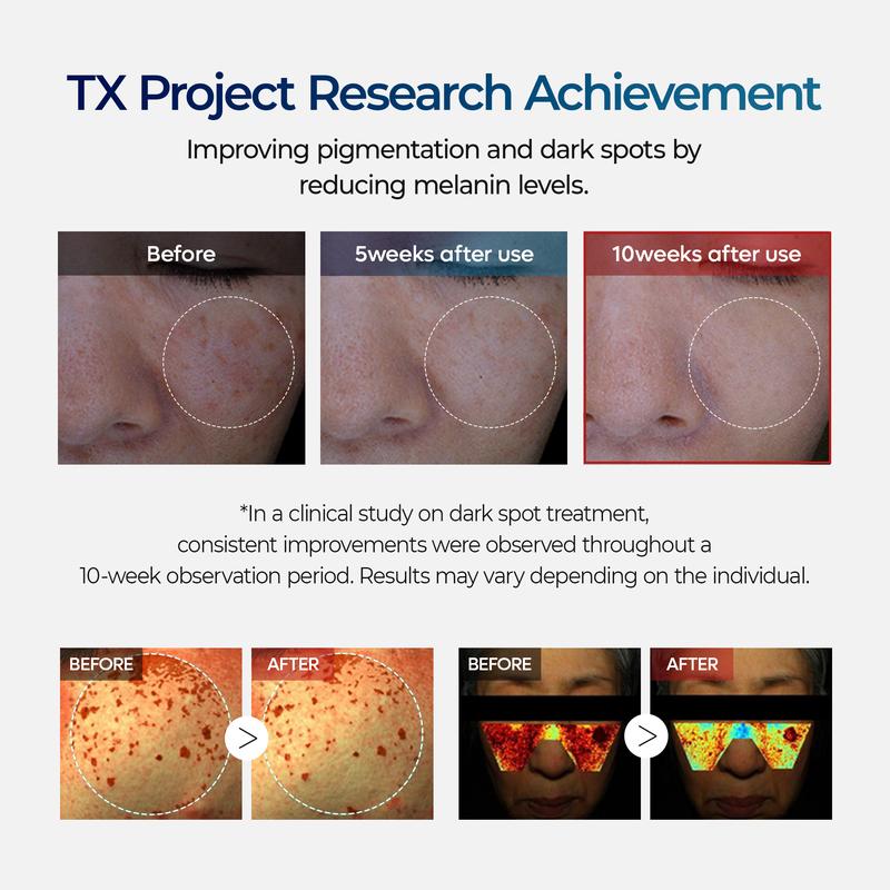 TX Cream – Dark Spot & Hyperpigmentation Corrector
