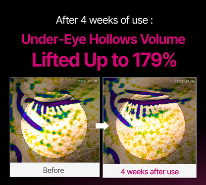 🔥LAST DAY 50% OFF!! Yoopulse Korean Calcium Dark Spot Eye Cream