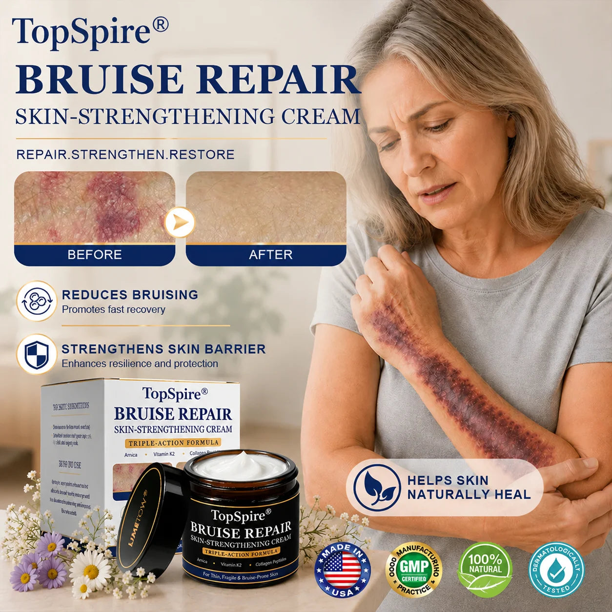 🏆Official US Store🔥TopSpire® Bruise Repair & Skin-Strengthening Cream