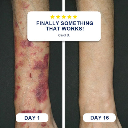 🏆Official US Store🔥TopSpire® Bruise Repair & Skin-Strengthening Cream