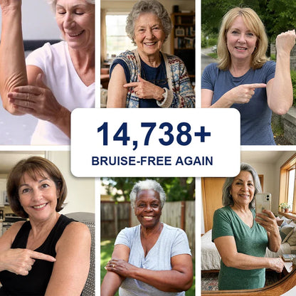 🏆Official US Store🔥TopSpire® Bruise Repair & Skin-Strengthening Cream
