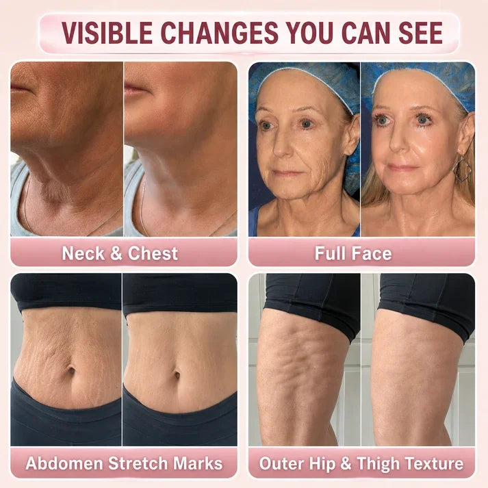 TopSpire®🌸 Botox-Inspired Pure Collagen Firming Wand — Needle-Free Fine Line Smoothing, Firming & Plumping Skincare Balm
