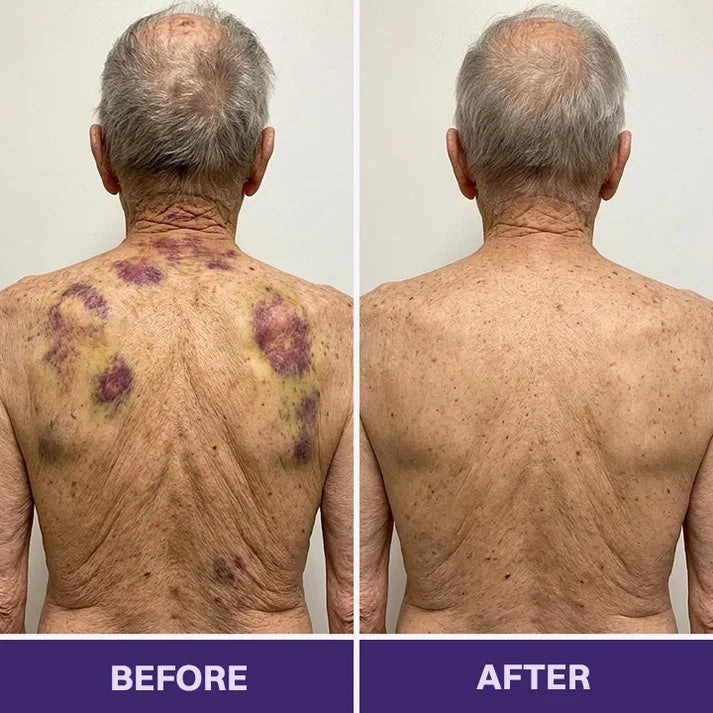 TOPSPIRE® Bruise Repair & Skin-Strengthening Cream