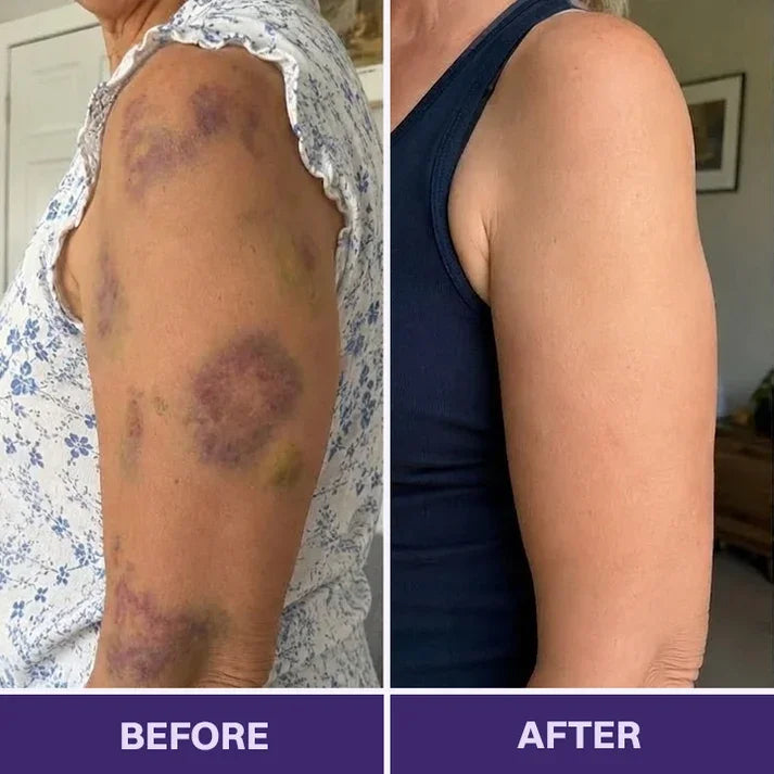 TOPSPIRE® Bruise Repair & Skin-Strengthening Cream