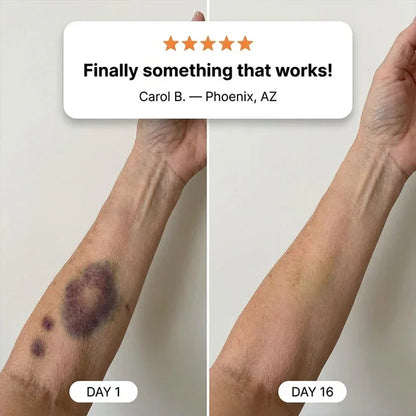 TOPSPIRE® Bruise Repair & Skin-Strengthening Cream