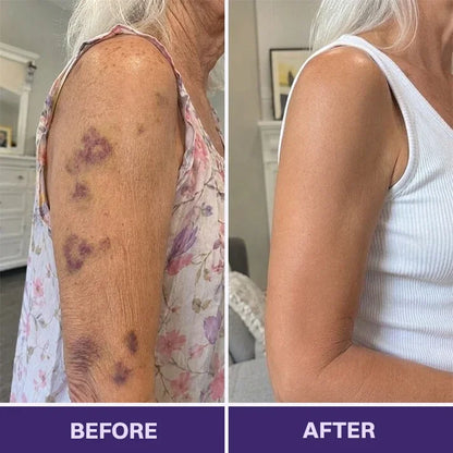 TOPSPIRE® Bruise Repair & Skin-Strengthening Cream