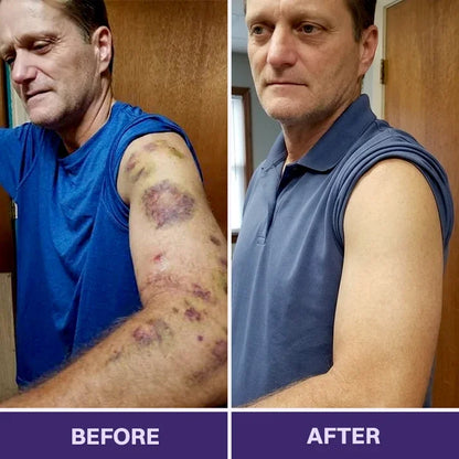 TOPSPIRE® Bruise Repair & Skin-Strengthening Cream